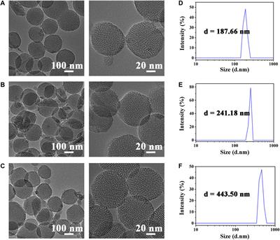 Preparation of the Biodegradable Lymphatic Targeting Imaging Agent Based on the Indocyanine Green Mesoporous Silicon System